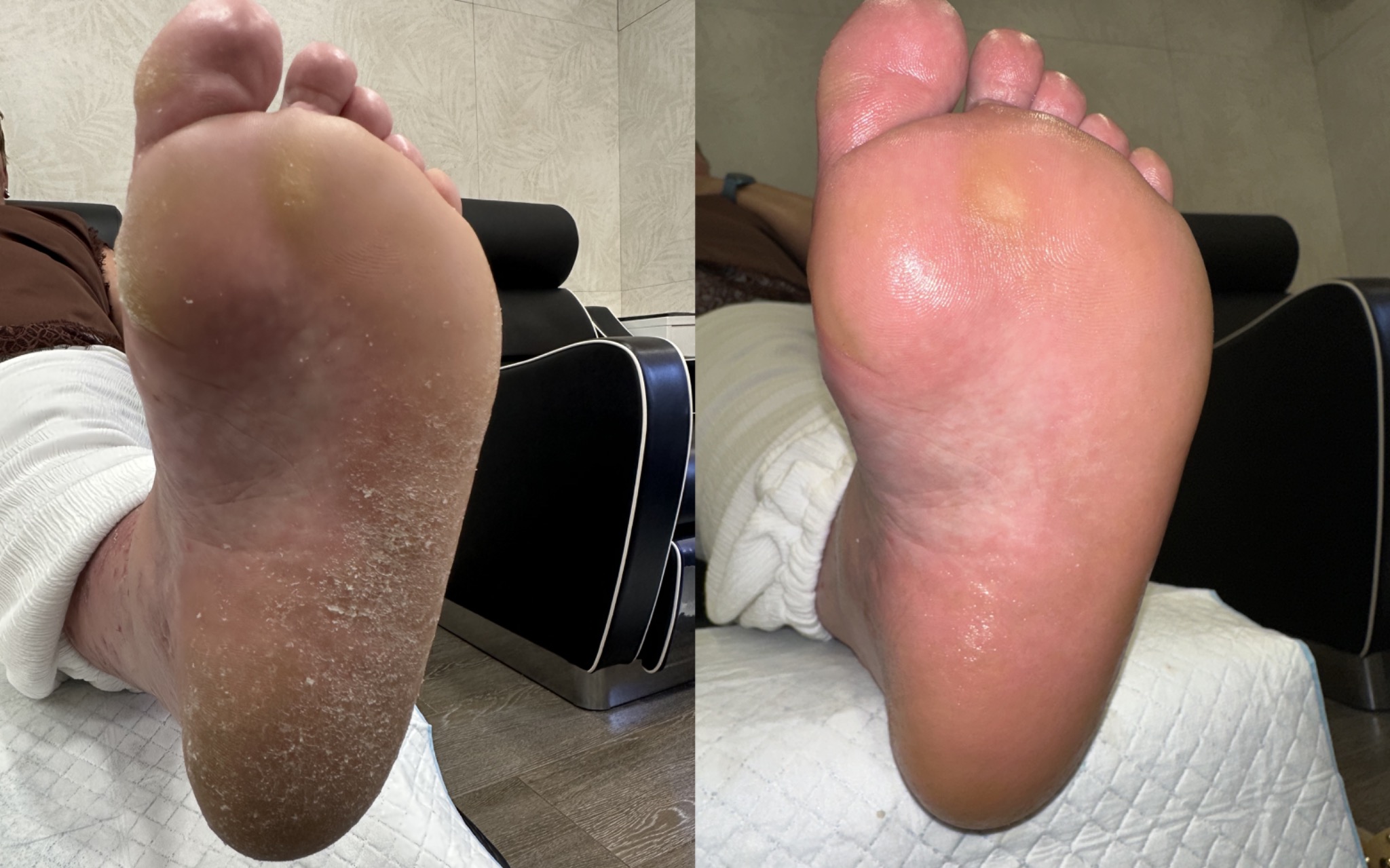 Before and after foot care treatment